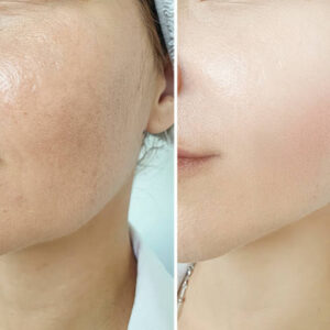 Choosing Organic Skincare: A Guide to Safer Beauty Products